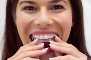 Learn about Invisalign alternatives in Farmington, MI