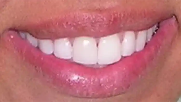 smile gallery image