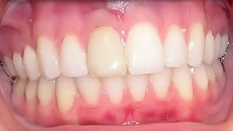 smile gallery image