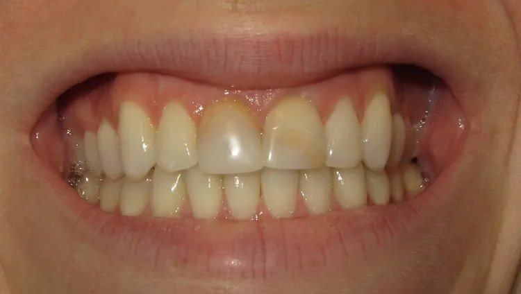 smile gallery image