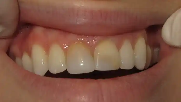 smile gallery image