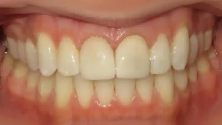 smile gallery image