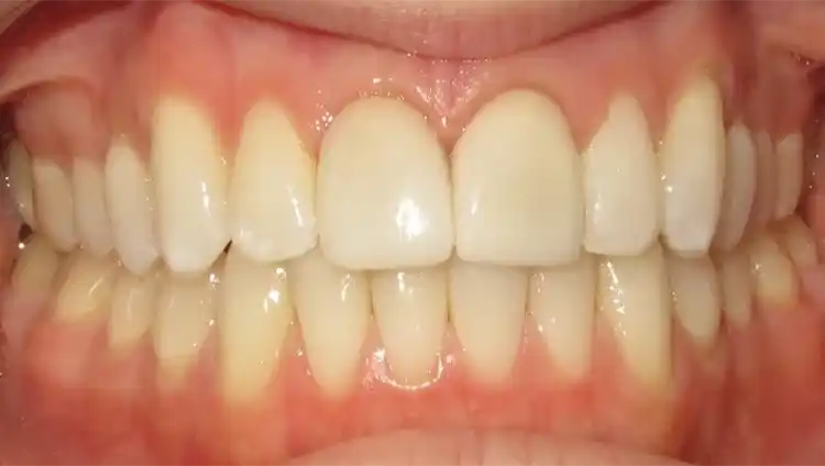 smile gallery image