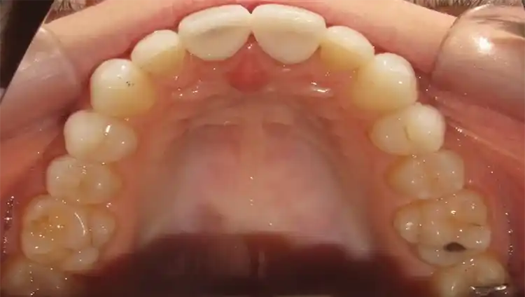 smile gallery image
