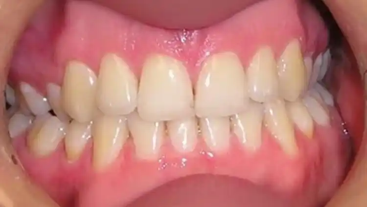 smile gallery image