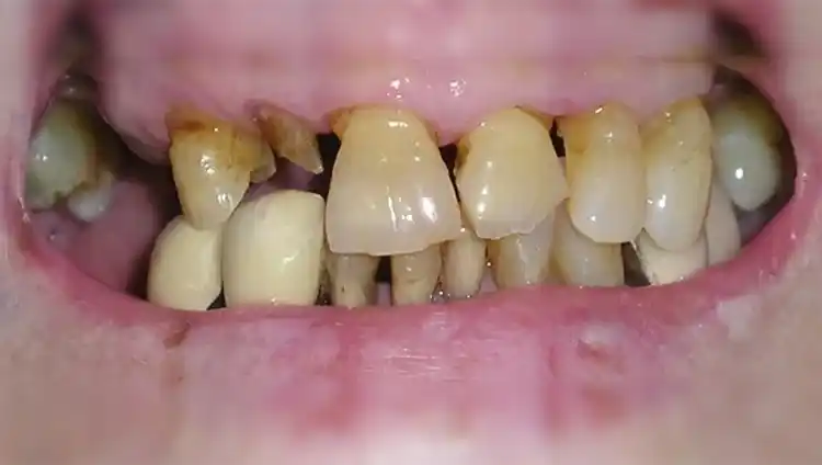 smile gallery image