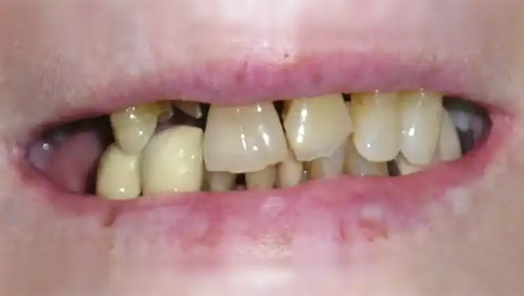 smile gallery image