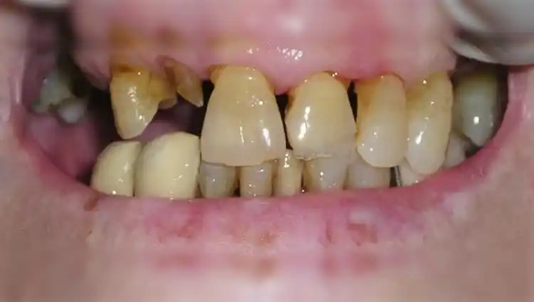 smile gallery image