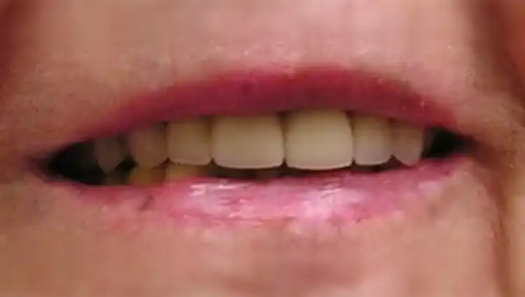 smile gallery image