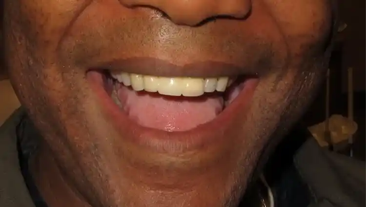 smile gallery image