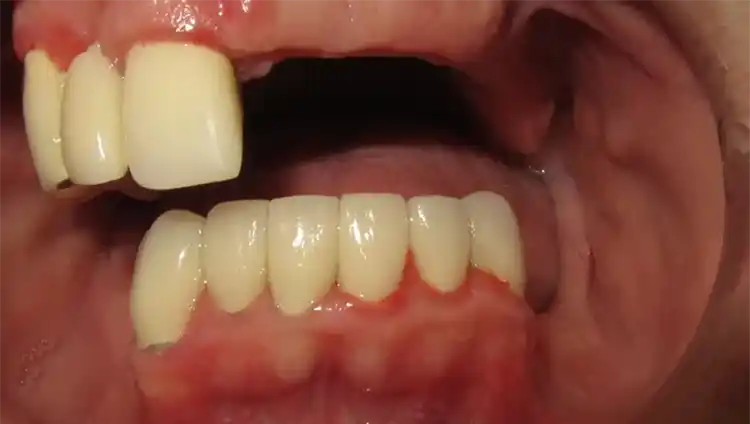 smile gallery image