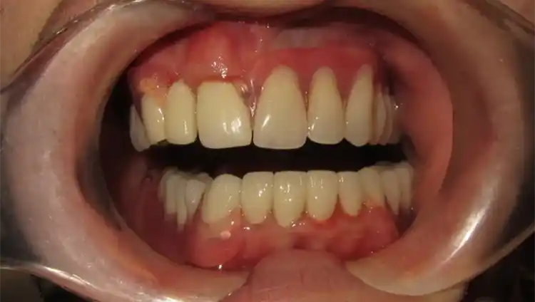 smile gallery image