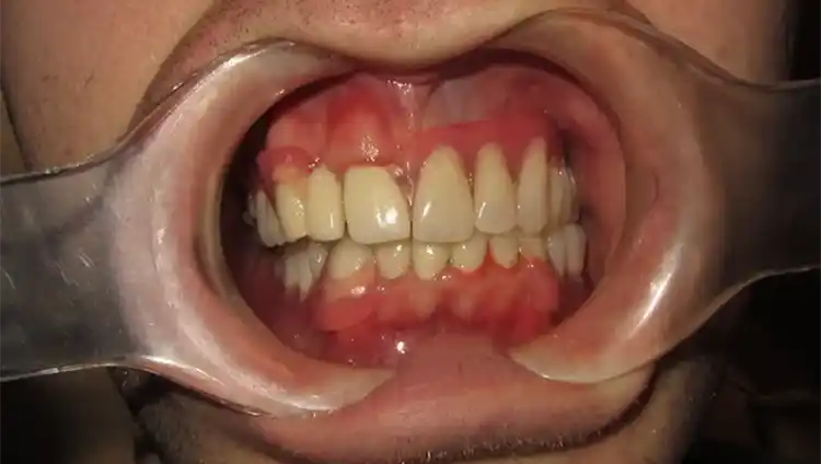 smile gallery image