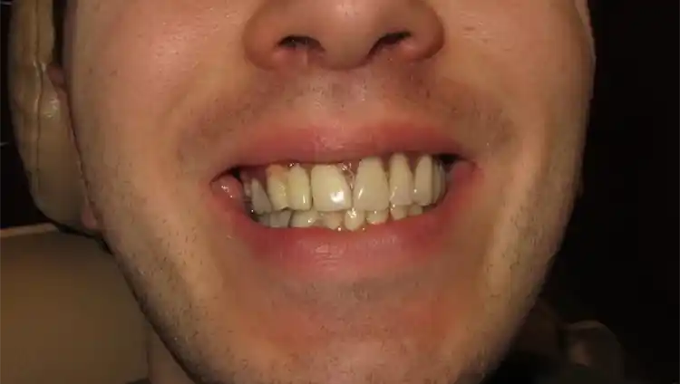 smile gallery image