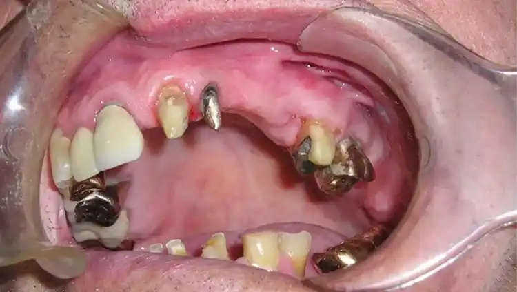 smile gallery image