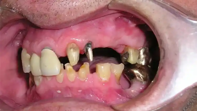 smile gallery image