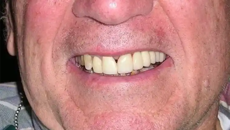 smile gallery image