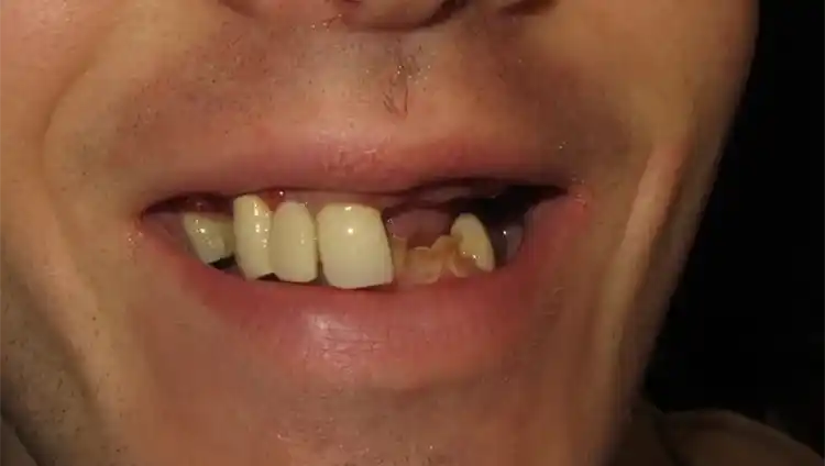 smile gallery image