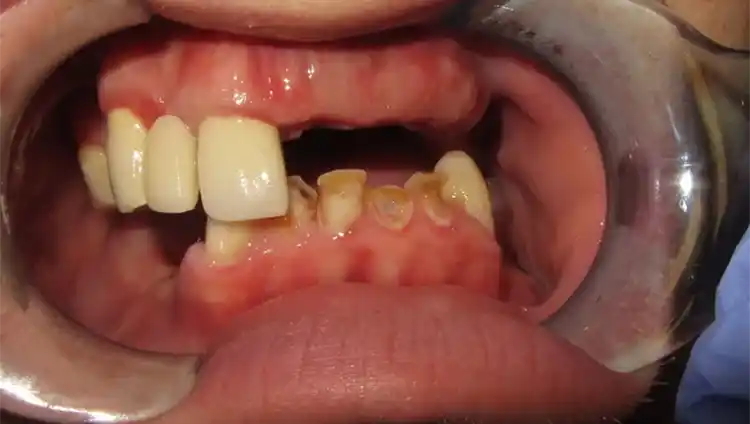 smile gallery image