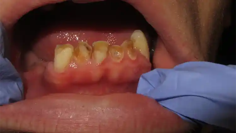 smile gallery image