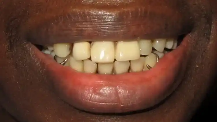 smile gallery image