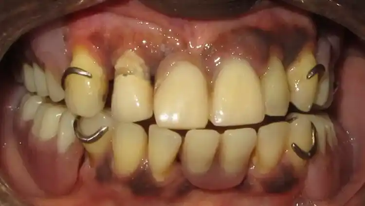 smile gallery image