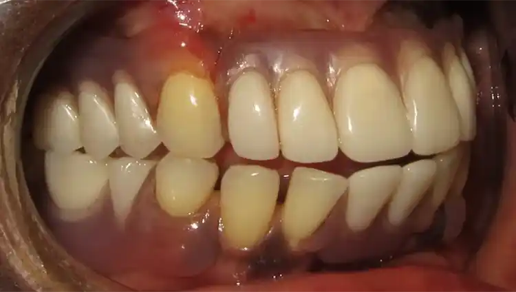 smile gallery image