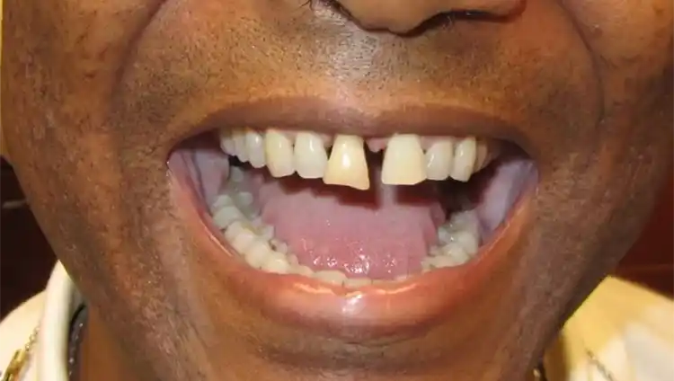 smile gallery image