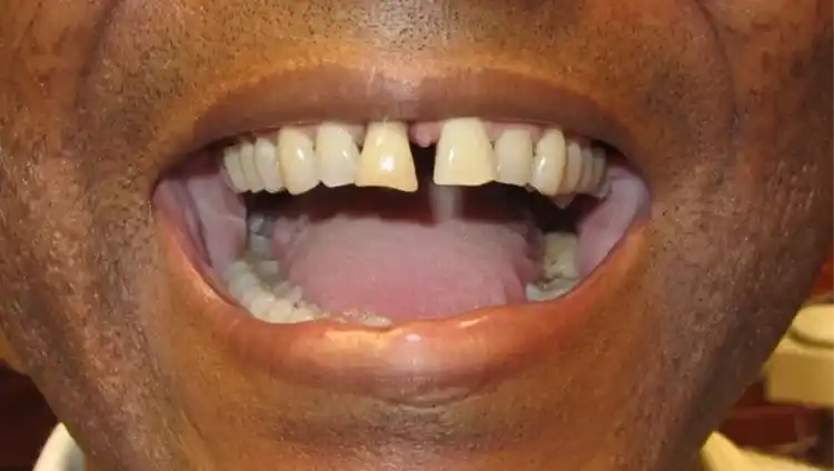 smile gallery image