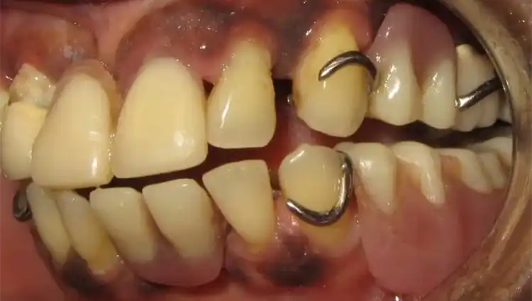 smile gallery image